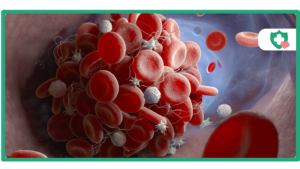 Does Tirzepatide Cause Blood Clots