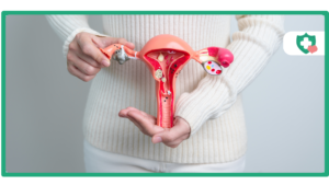 Can Tirzepatide Help Manage Polycystic Ovary Syndrome (PCOS)?
