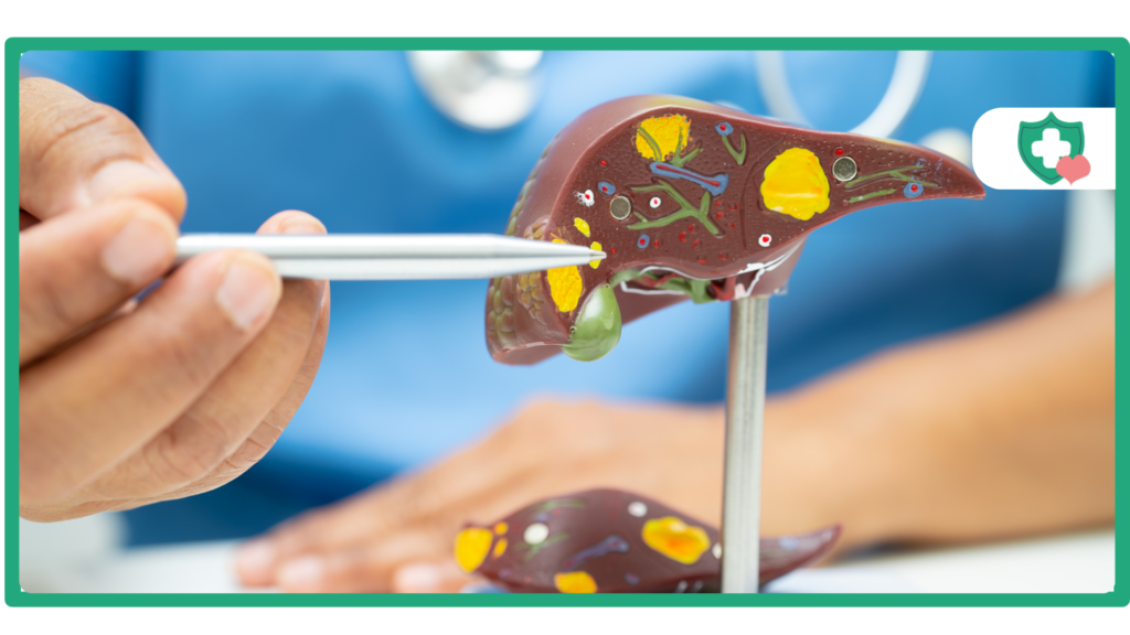 Does Tirzepatide Help with Fatty Liver Disease?