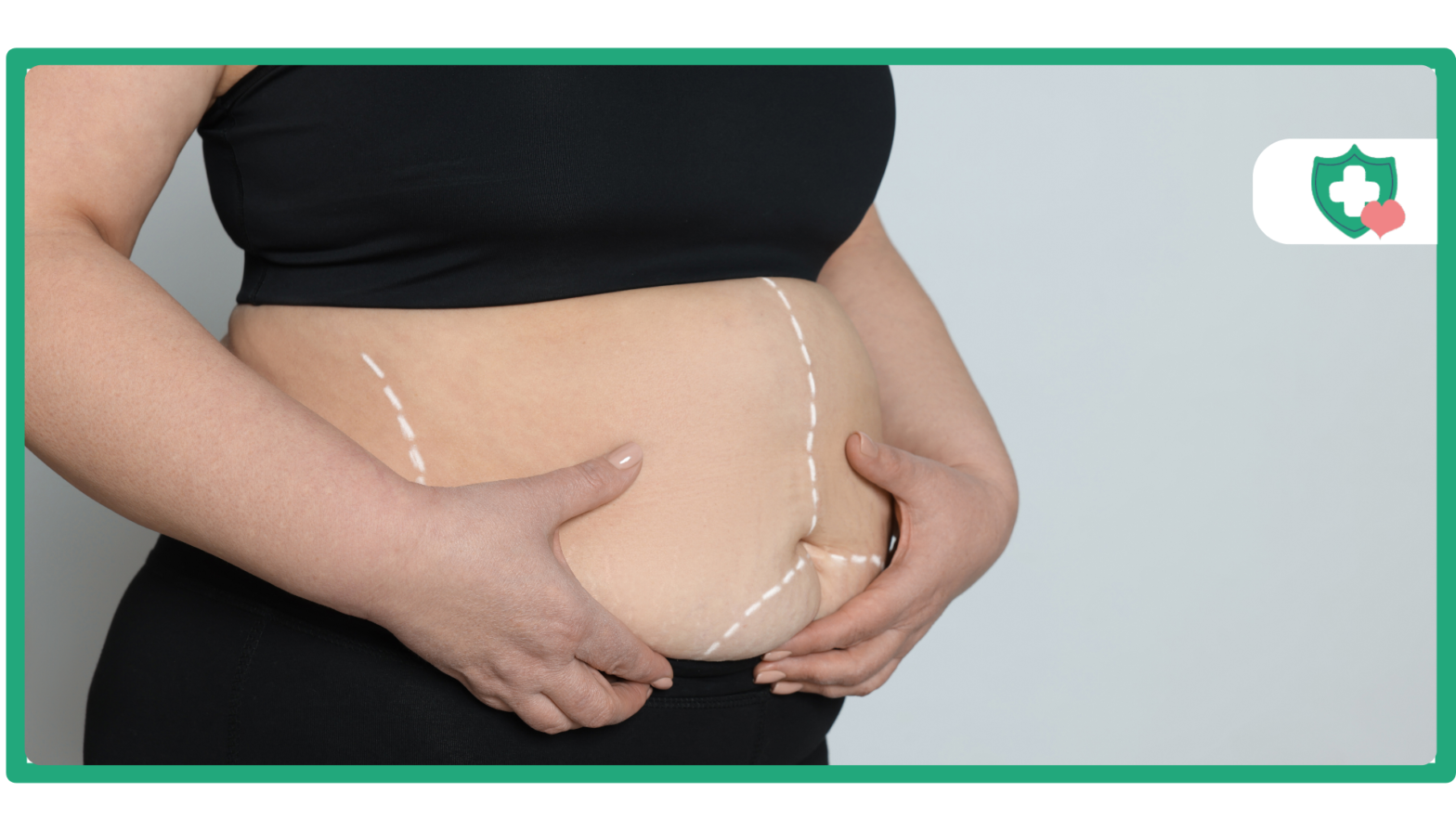 Is Tirzepatide More Effective for Weight Loss Than Bariatric Surgery?