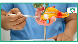 Is Tirzepatide Safe for People with a History of Pancreatitis?
