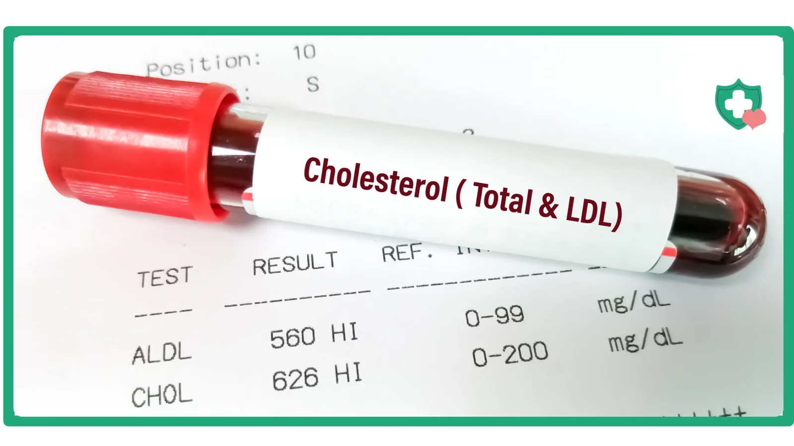 Is Tirzepatide Suitable for People with High Cholesterol?